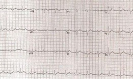 文安吃瓜心电图,揭秘网络热点的脉动与心声