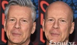 吃瓜秃头男人,揭秘娱乐圈的“秃顶”现象