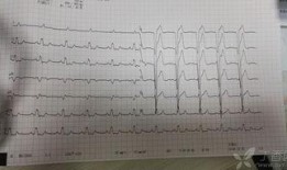 文安吃瓜心电图,揭秘网络热点的脉动与心声